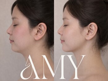 エイミー(Amy)/【Before/After】