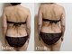 ヨサパーク リュミエール 松本店(YOSAPARK lumiere)の写真/目に見える結果を速攻実感！食べ過ぎもルルオンで脂肪燃焼&デトックス！