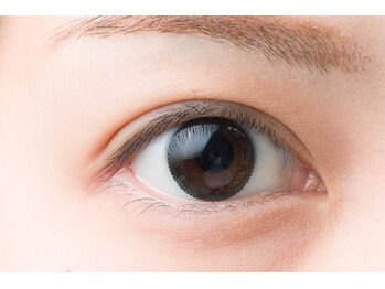 マイオール 銀座店(My ALL)/【施術例】装着前