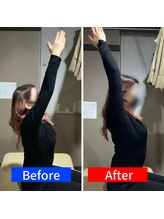 ナオル整体 岐阜院(NAORU整体)/20代女性「肩こりを改善したい」