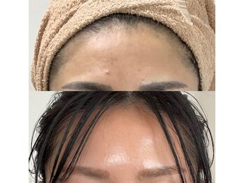 エヌ アンド エイチ ソニックフィット(N&H sonicfit)/ハリ艶が欲しい方おすすめコース