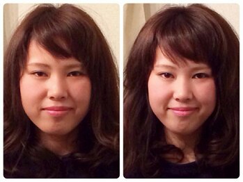 ア ニュームーン 京都烏丸店(a New Moon)/小顔矯正ビフォーアフター