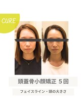 整体 オンセ(整体ONCE)/大人気小顔矯正☆