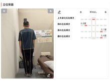 かがりの整骨院 鍼灸院/AIによる姿勢分析（後面）