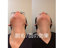 バロンの雰囲気（効果もしっかり実感いただけます。）