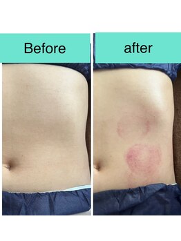 アスピリア(aspirer a')/緩めて流して引き締める！