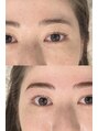 オムズアイ(om's eye.) まつ毛・眉毛のセットメニューお任せください◎