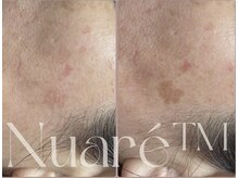 エスビーエス オキナワ(SBS OKINAWA)の雰囲気（おもろまち/真嘉比/シミケア/）