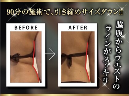 ボディメイクサロン アクア(aqua)の写真