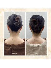 プレメ 人形町院(The Preme)/くびケアスリム　２回施術後