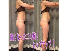 ボディエステティック アクアオーラ 富山店/スッキリ二の腕！