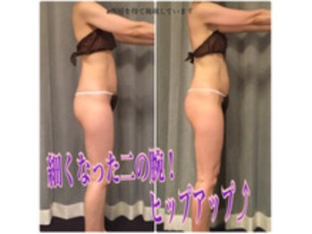 ボディエステティック アクアオーラ 富山店/スッキリ二の腕！