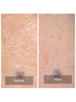 グリーンノート(GREEN NOTE)/ハ-ブピ-リング