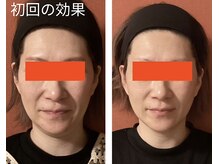 ロイヤリティ(ROYALTY)/二重アゴ、フェイスライン