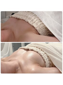 カナエルサロン 旭川(KANAERU SALON)/【バストアップ】症例☆