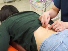 ヤマグチ美容整体院/鍼灸で体の調子を整える
