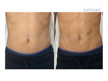 メディカルエステ 新宿南口店/*日本初上陸次世代EMS症例写真