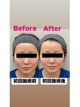 ゆうはり鍼灸整骨院 恵比寿/お客様Before　After