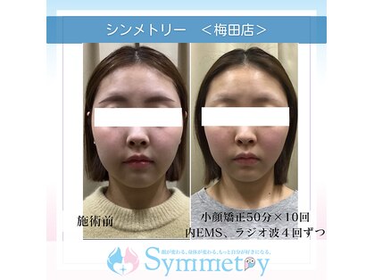 小顔矯正専門店 シンメトリー 梅田の写真