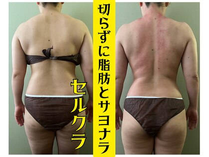 モモリラ(momorila)の写真