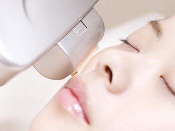 ムーンライズ(moonrise)の写真/【フォトIPL】シミやくすみに速変化◎化粧品では届かない肌の奥にアプローチ[¥3300][美肌]