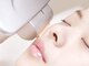 ムーンライズ(moonrise)の写真/【フォトIPL】シミやくすみに速変化◎化粧品では届かない肌の奥にアプローチ[¥3300][美肌]