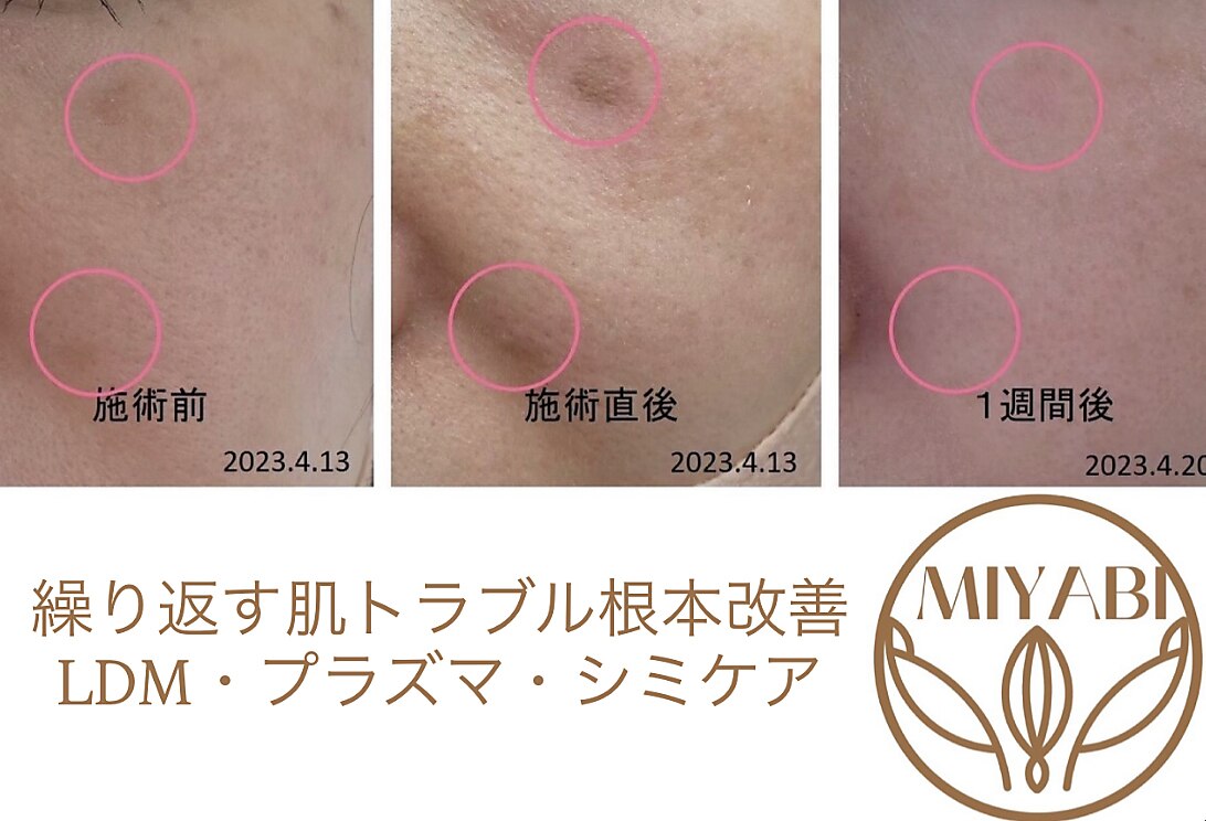 ミヤビ(MIYABI)｜ホットペッパービューティー