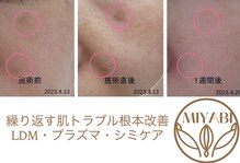 ミヤビ(MIYABI)