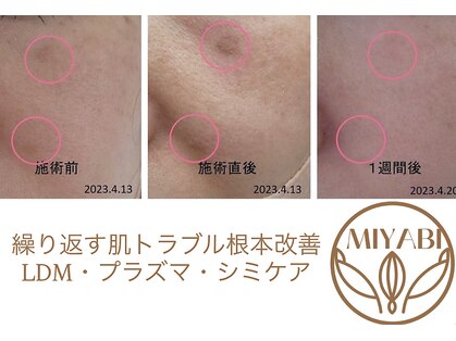 ミヤビ(MIYABI)の写真