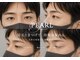 パールアイ 心斎橋堀江(PEARL eye)の写真