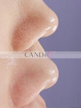 キャンディ 難波心斎橋店(CANDi)&nbsp;剥離の加減 調整可能