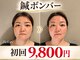 ラ コンシェル たまプラーザ店の写真/【大人の本気エイジングケア】たるみ・ほうれい線・フェイスラインのもたつきに、本格美容鍼★