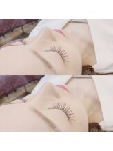 フリルアイビューティ 豊中店(Frill Eye Beauty)/