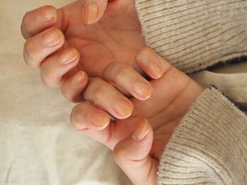 タクミ カルム TAKUMI CALME/ちゅるりん　