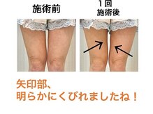 鍼灸サロンオランジュ 高槻富田院/