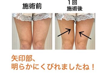 鍼灸サロンオランジュ 高槻富田院/