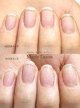 マリーロール 梅田店(Marie Laure)/自爪育成/深爪矯正/ネイルケア