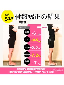 セレンディピティ 守山店(Serendipity)/５１歳 6.5キロ減　骨盤矯正痩身