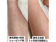 チュベルフェ(tu belle fe)の雰囲気(ハイパワー&ハイブリッド脱毛で痛み回数少なく自己処理から解放)