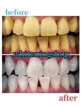 ホワイトニングショップ 豊田店(WHITENING SHOP)/ホワイトニングの効果