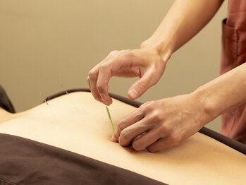 ジネコラボ 藤沢院(Gyneco-labo)の写真/なかなか改善されない頑固な首肩こり・頭痛でお悩みの方へ◎はじめての方にもおすすめ♪