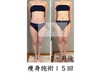 アイ エステサロン(Ai)/着たい服が着れる喜び♪