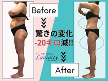 ラヴィニティ 自由が丘店(Lavinity)