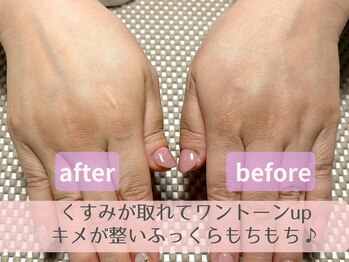 ルポ(Repos)/step3＊ミストでしっとり保湿