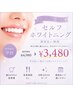 【U24学割】都度払い◆セルフホワイトニング1回¥3480