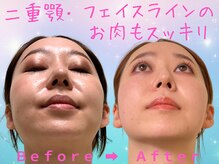 ナチュラルパーフェクトフェイス 新宿の雰囲気（小顔矯正初めての方にお薦め☆お悩みをご相談ください/新宿小顔）