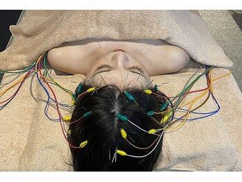 ウル(ulu)/即寝落ち頭皮鍼★男性におすすめ