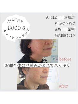 わたしの。三島店/セルフエステのbefore after♪