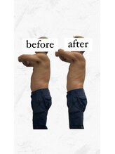 ビーアイリー(Be irie)/痩身エステ直後の変化