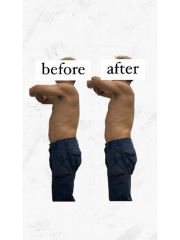 ビーアイリー(Be irie)/痩身エステ直後の変化